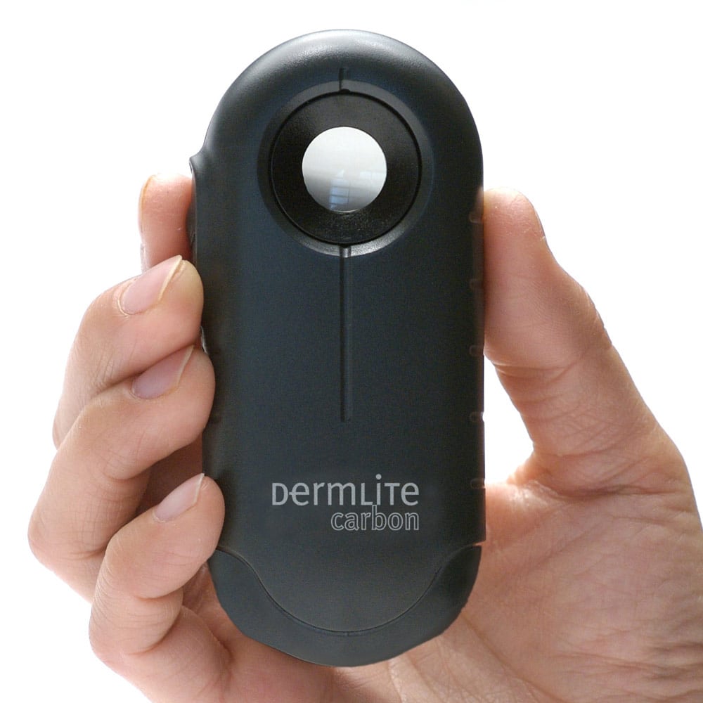 DermLite Carbon Dermatoscope - Image 2