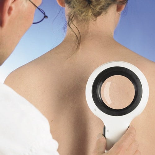 DermLite Lumio, Magnifying Light Dermatoscope LED - Image 3